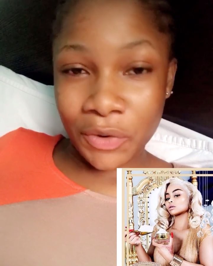 Sexy Instagram Slay Queen Blast Nigerians For Bashing Blac Chyna Who Came To Sell Her Bleaching