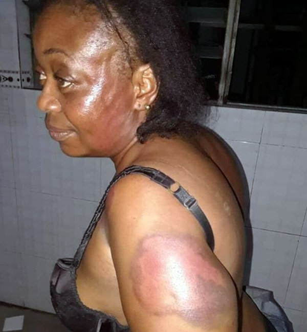 Nigerian Lawmaker Allegedly Beats Wom