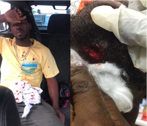 Singer, Orezi Survives Car Crash On Third Mainaland Bridge, Suffers ‘Broken Jaw’ 1