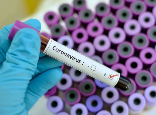 Coronavirus Kills Seven Nigerians In 24 Hours As Cases Continue to Rise